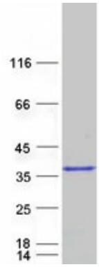 Coomassie blue staining of purified CASP7 protein.